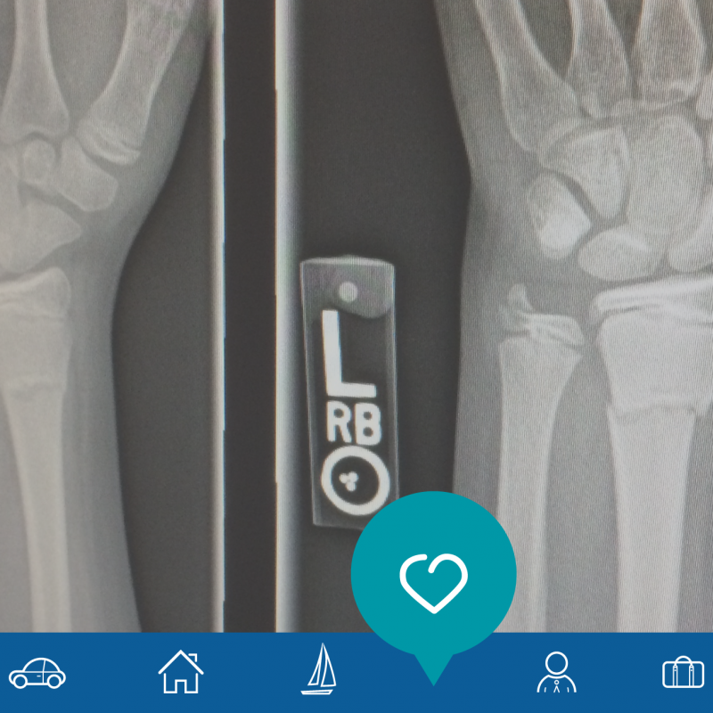 Common Sports Injuries